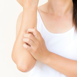 Wildfires can make us itch!