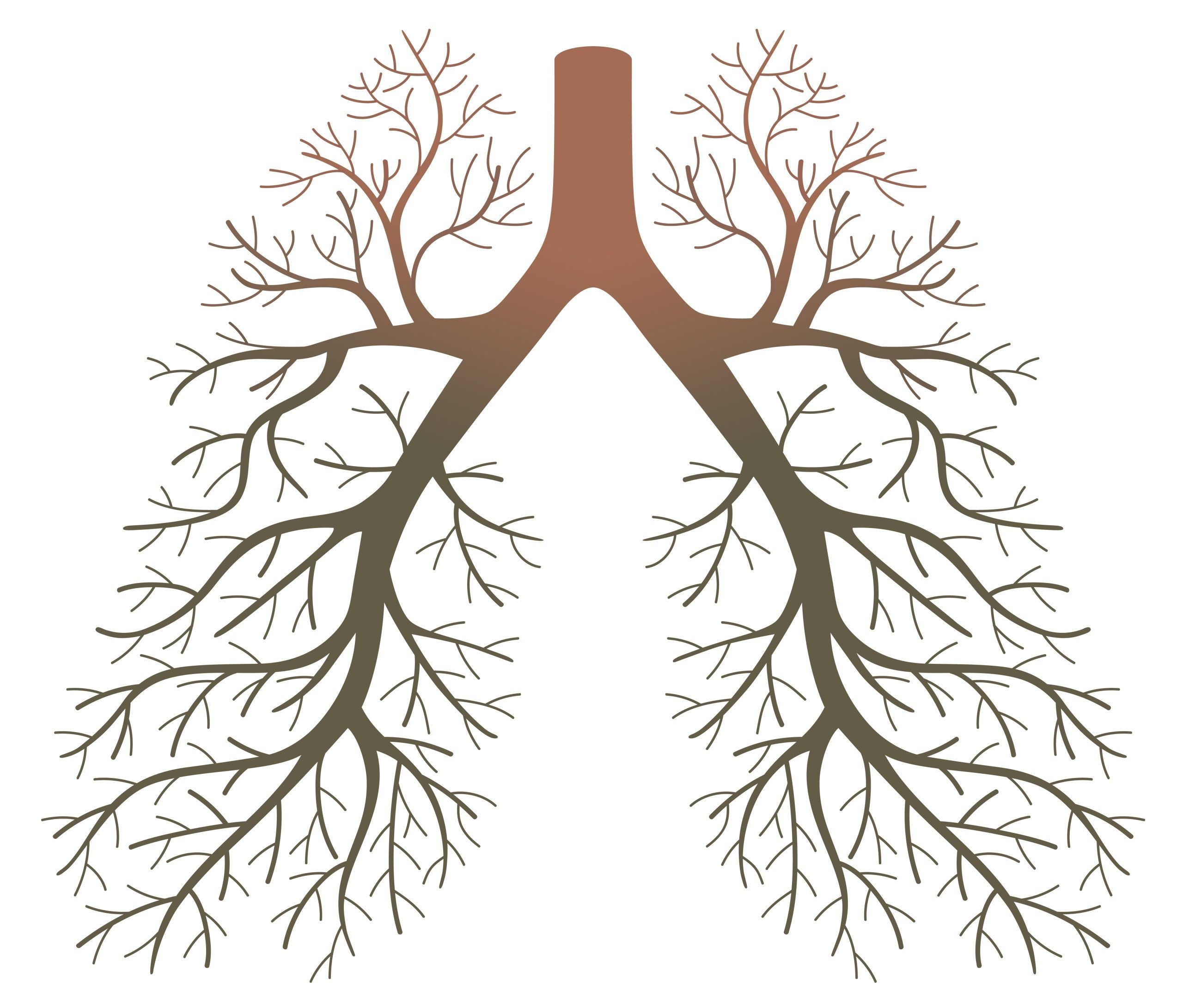 Hypersensitivity Pneumonitis