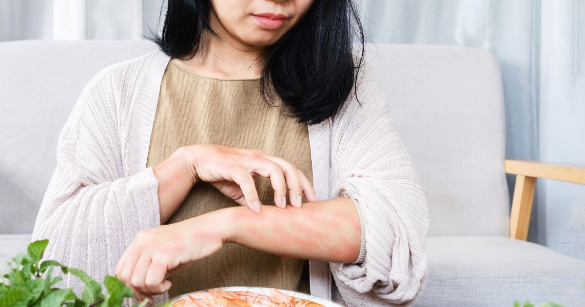 Woman with skin rash scratching her arm