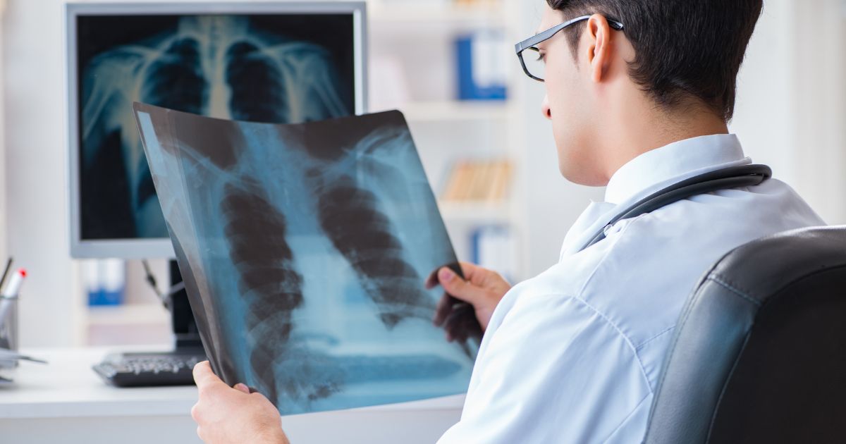 Doctor looking at scan of lungs